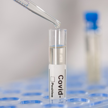 ������������ ���������� �� COVID-19: ����� �� ������� � ����