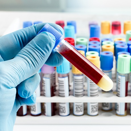 ������� ������ 25 ��� ����� ��� � 10 ��� ��������� �� ������� �������� � � ������ ���������������