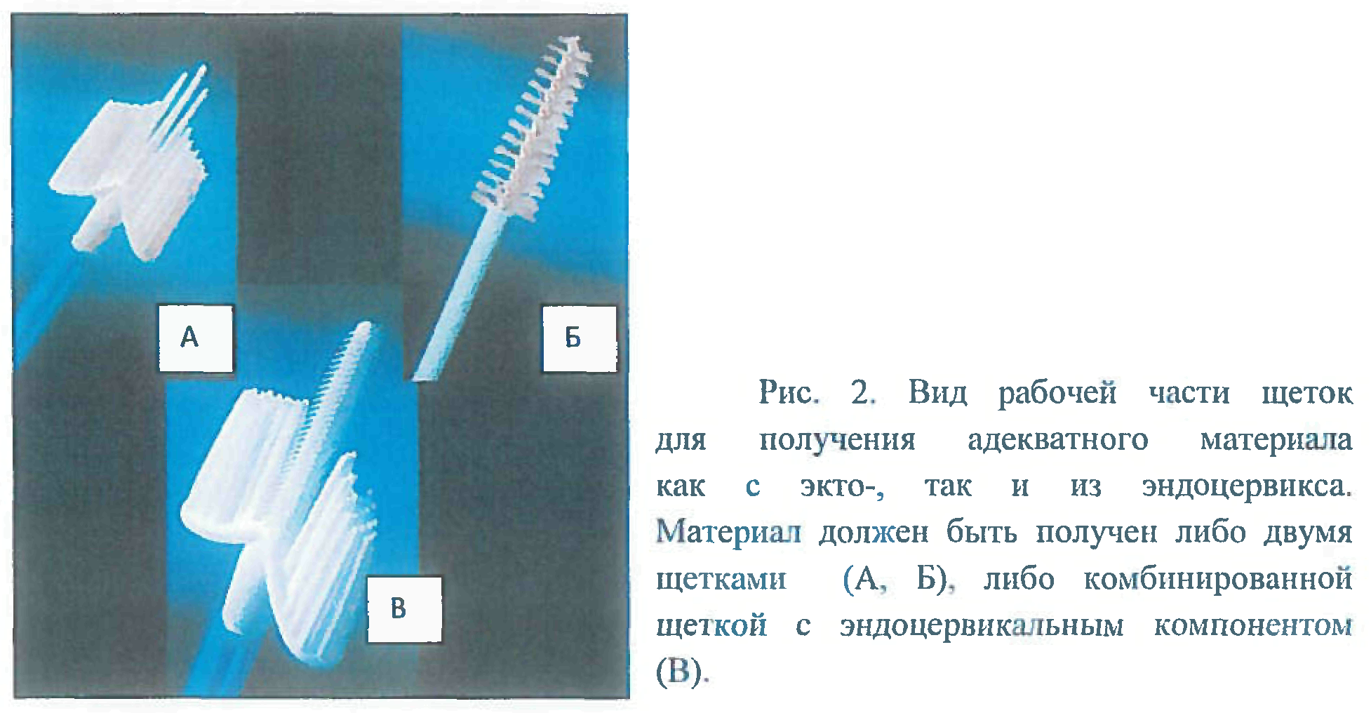 Материал из цервикального канала