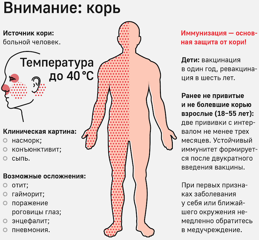 Плановой вакцинации против кори подлежат не болевшие корью